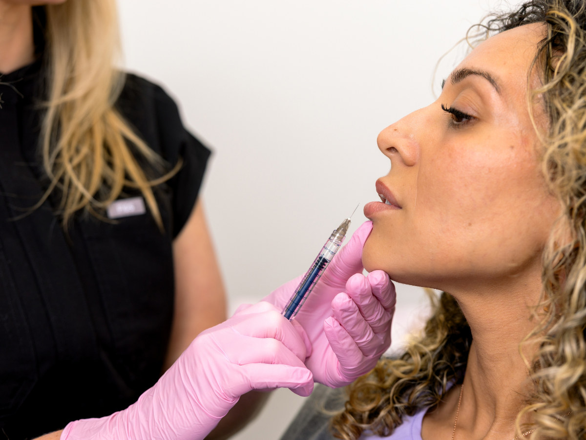 Lip filler