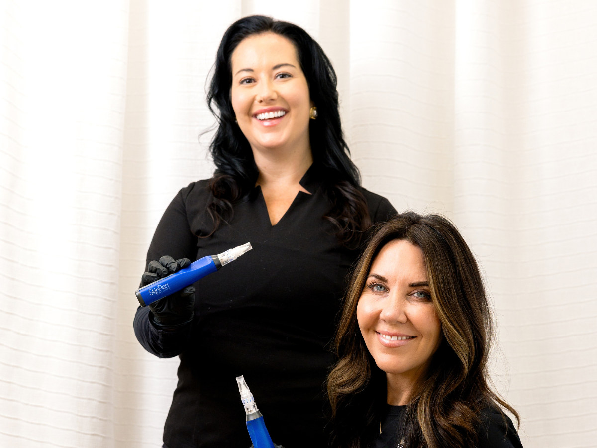 SkinPen microneedling with PRP