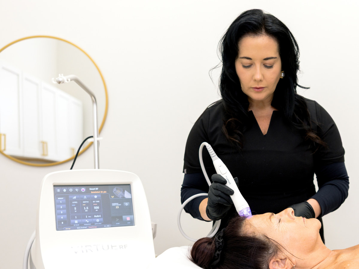Virtue RF microneedling